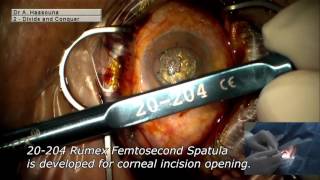 20-204 Spatula for Femtosecond Laser Procedure, Length 120 mm, Round Titanium Handle - Image 3